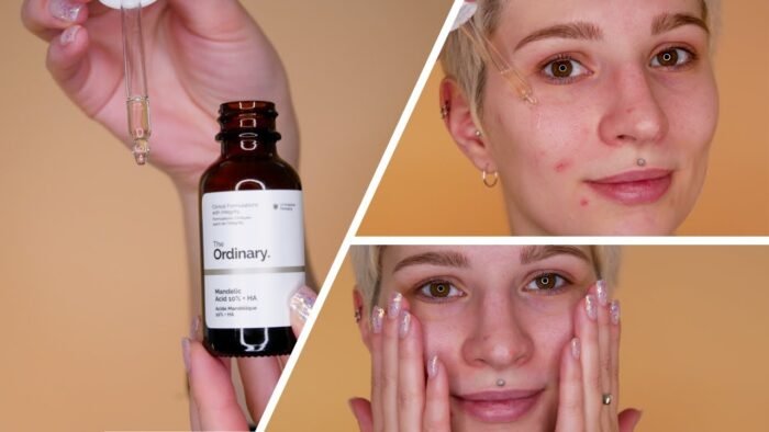 The Ordinary Mandelic Acid