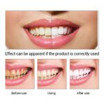 Teeth Whitening Essence